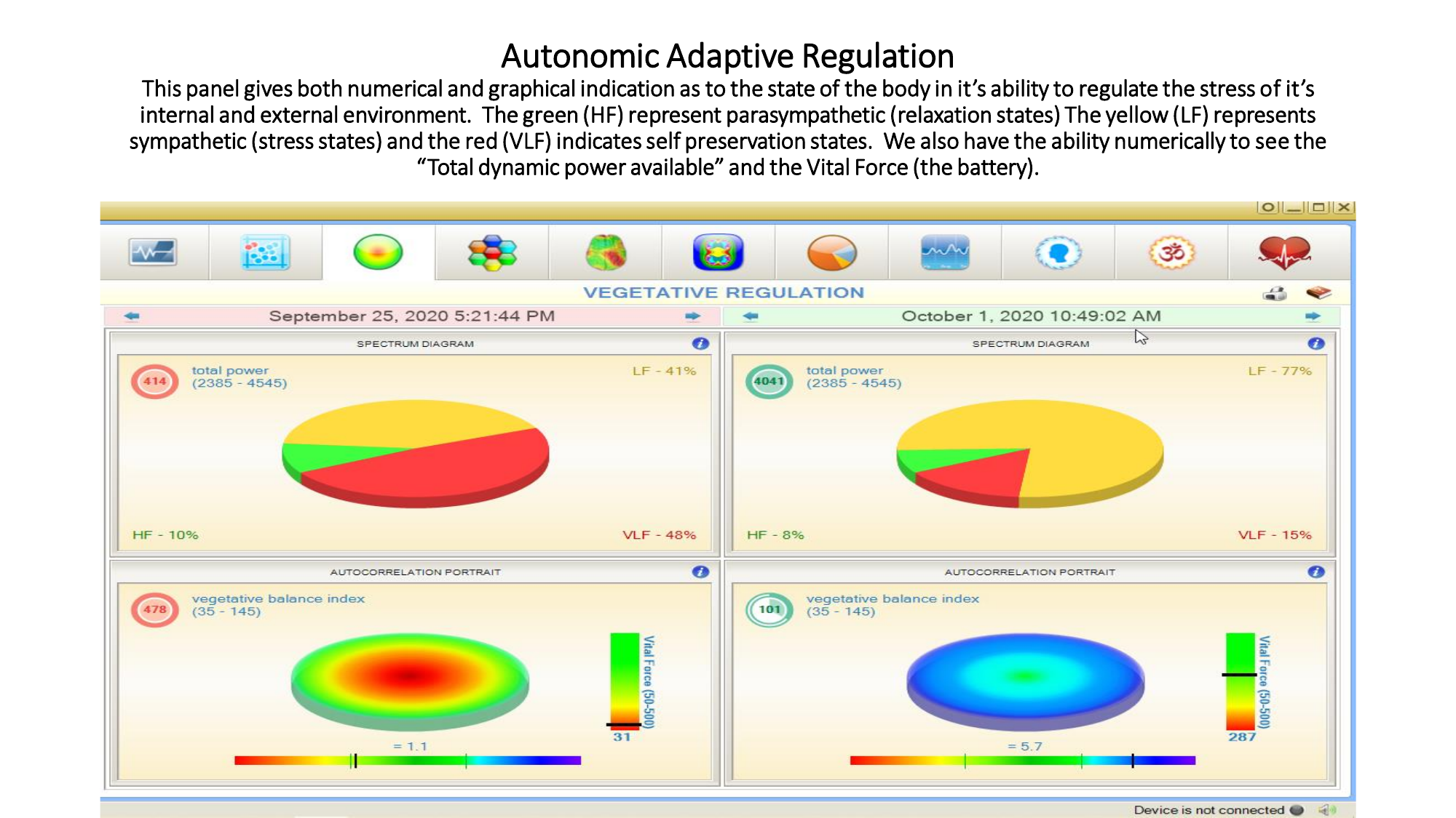 VScan HRV sample report showing heart rate variability and nervous system analysis