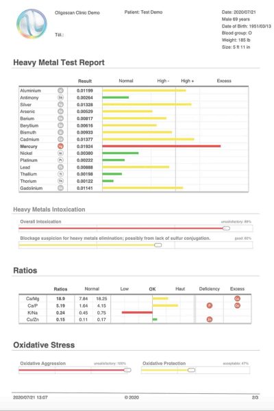 Heavy Minerals Test Reports Sample