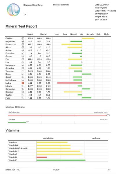Mineral Test Results Sample